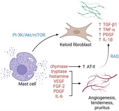 An updated review of the immunological mechanisms of keloid scars